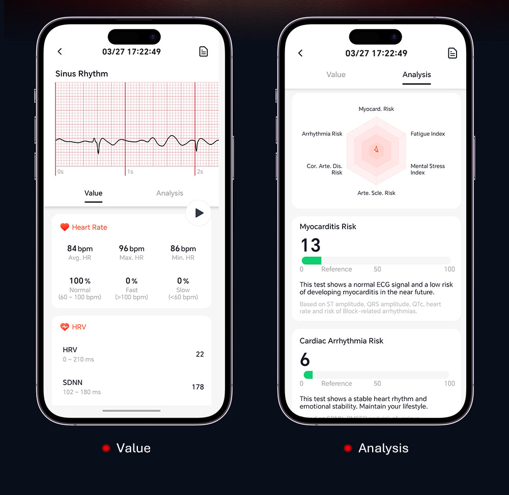 Bracelet Santé avec ECG fessionnel et Analyse IA